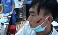 Cần có những chế tài đủ mạnh xử lý hành vi bạo hành trong lĩnh vực y tế Cần có những chế tài đủ mạnh xử lý hành vi bạo hành trong lĩnh vực y tế