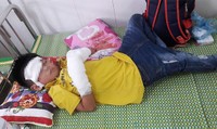 Điện thoại phát nổ, bé trai nát 2 bàn tay Điện thoại phát nổ, bé trai nát 2 bàn tay