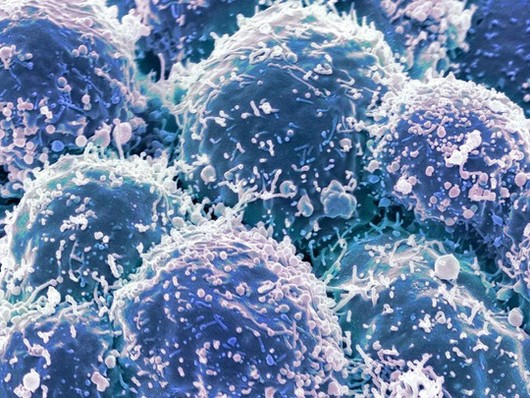 Chế tạo thành công loại virus chuyên diệt tế bào ung thư Chế tạo thành công loại virus chuyên diệt tế bào ung thư