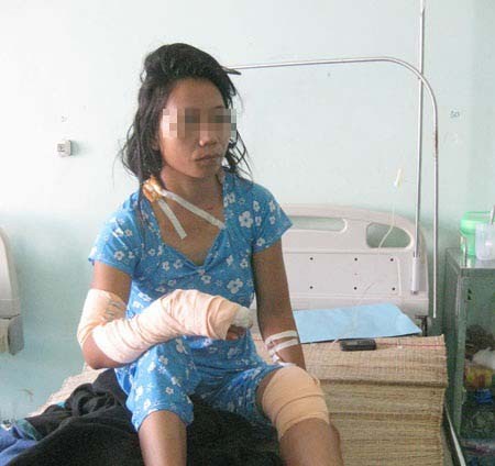 Chị H. vẫn chưa hết bàng hoàng về những trận đòn roi của chồng