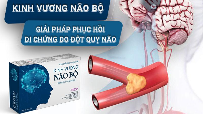 Kinh Vương Não Bộ - Giải pháp hỗ trợ phục hồi di chứng do đột quỵ não | Báo  Pháp luật Việt Nam điện tử