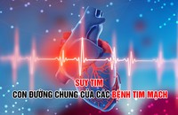 Suy tim - Hậu quả chung của các bệnh tim mạch