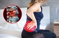 Bệnh thoái hoá cột sống thắt lưng L4 L5 và giải pháp từ Cốt Thoái Vương