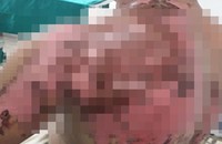 Diễn biến vụ “cố ý gây thương tích” tại Nam Từ Liêm: Cơ quan CSĐT phục hồi điều tra lần 2