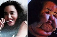 Nữ diễn viên Han Mi Ok qua đời ở tuổi 57 bà là thảm họa của ngành phẫu thuật thẩm mỹ của Hàn Quốc.