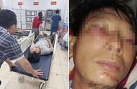 Theo người nhà anh H, hiện anh H vẫn trong tình trạng choáng váng, đang được theo dõi tại Bệnh viện Đa khoa tỉnh Hà Tĩnh, các bác sỹ đang tiếp tục cho chụp chiếu để kiểm tra tổn thương.
