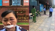 Nữ bảo vệ chung cư Nam Đô nghi bị nhân viên giao hàng ném điện thoại gây bị thương. Ảnh: Cư dân cung cấp