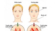Ích Giáp Vương - Giải pháp cải thiện cường giáp hiệu quả, an toàn