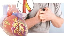 Nhồi máu cơ tim cần phòng ngừa sớm, giảm nguy cơ tử vong