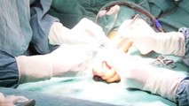 Kẹt tay vào cửa sắt, bé trai 21 tháng tuổi đứt lìa 2 đốt ngón tay