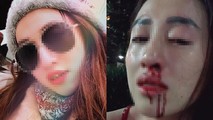 Vợ cực xinh bị chồng đánh gãy mũi trước mặt con, ly thân vẫn như 'địa ngục'