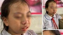 Tát học sinh lớp 4, cô giáo bị tạm đình chỉ công việc