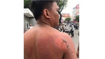 Người thi hành công vụ bị đối tượng quá khích tấn công, gây thương tích. Ảnh: Công an TP Cần Thơ.
