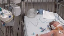 Bé gái đang được theo dõi tại khoa Điều trị tích cực. Ảnh: Bệnh viện Nhi Trung ương.