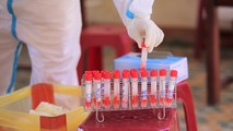 Giám đốc CDC Đà Nẵng cho biết, tất cả mẫu bệnh phẩm tại Đà Nẵng đều là chủng virus Anh, trong khi mẫu của BN số 3634 mang chủng virus Ấn Độ.
