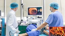 Cần kiểm tra sức khỏe định kỳ vì việc ăn uống không hợp lý khiến người trẻ tuổi đã mắc ung thư đại trực tràng