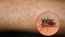 Bé trai 7 tuổi tử vong nghi mắc sốt xuất huyết