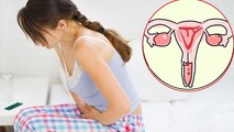 Tổ chức Y tế thế giới triển khai chiến lược loại bỏ ung thư cổ tử cung