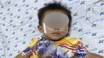 Sau gần 1 tuần điều trị, tình trạng trẻ cải thiện dần, tỉnh táo, được cai máy thở. Ảnh: BVCC