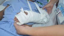 Phẫu thuật thành công bàn tay bị đứt lìa