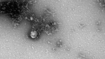 Hình ảnh hiển vi của biến thể virus SARS-CoV-2 mới. Ảnh: Rospotrebnadzor.