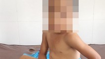 Mẹ “làm ngơ” cho con trai 6 tuổi bị cha dượng bạo hành dã man