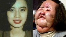 Han Mi Ok khi trẻ và khi khuôn mặt bị biến dạng vì thẩm mỹ.