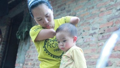 Thiệt thòi như phụ nữ khuyết tật