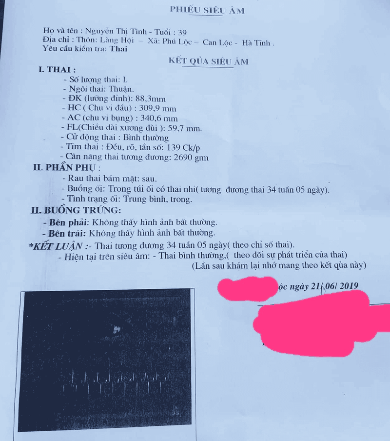 Vụ trẻ sơ sinh tử vong với vết đứt cổ thông tin bất ngờ từ bác sỹ siêu âm