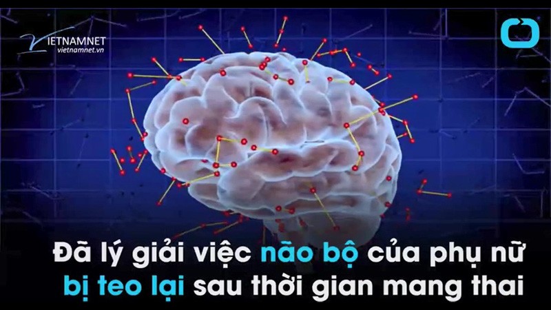 mang thai, phụ nữ có thai, não bộ mang thai, phụ nữ có thai, não bộ