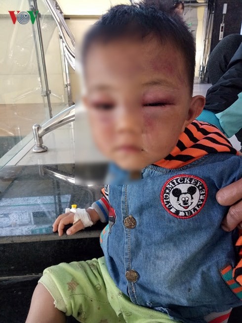làm rõ vụ việc bé trai 2 tuổi nghi bị cha dượng bạo hành đến nhập viện hình 1 lam ro vu viec be trai 2 tuoi nghi bi cha duong bao hanh den nhap vien hinh 1