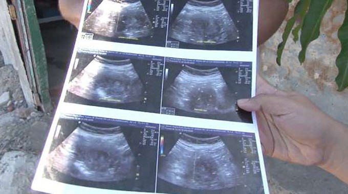 Cụ bà người Mexico khoe ảnh chụp siêu âm để chứng tỏ rằng mình thực sự đang có bầu. Ảnh:CEN/La Republica.
