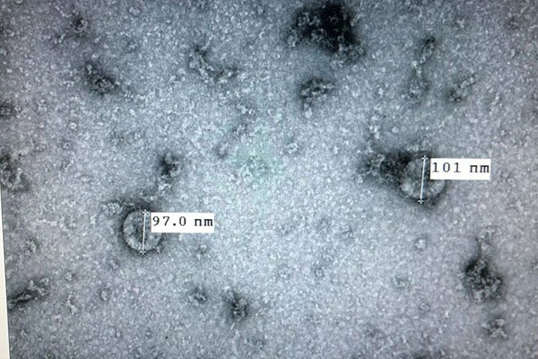 Việt Nam nuôi cấy, phân lập thành công virus corona mới Việt Nam nuôi cấy, phân lập thành công virus corona mới