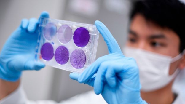 Du bao tich cuc ve kha nang mien dich lau dai cua benh nhan Covid-19 hinh anh 2 111998723_1200_vaccine_gettyimages_1208286355.jpg
