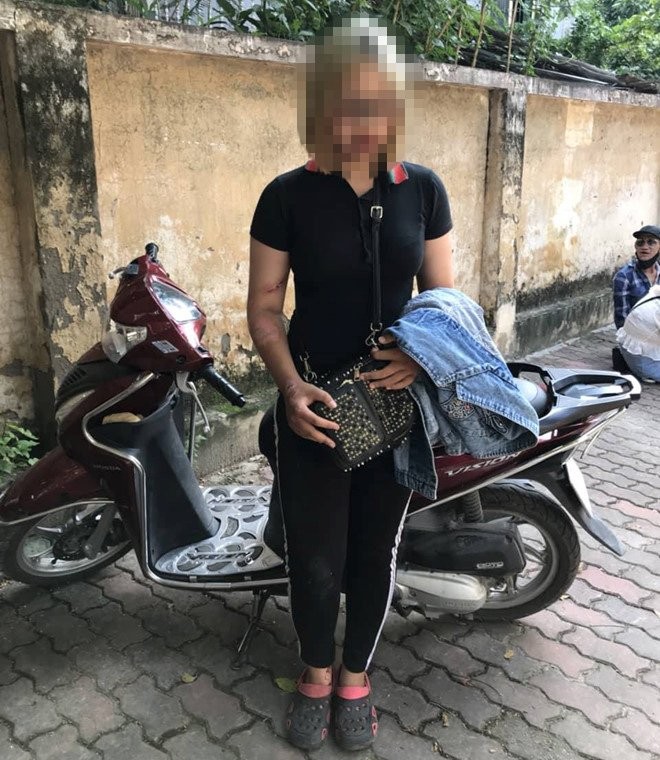 {title} Hà Nội: Thiếu nữ 15 tuổi đi xe máy đâm cảnh sát cơ động gãy chân
