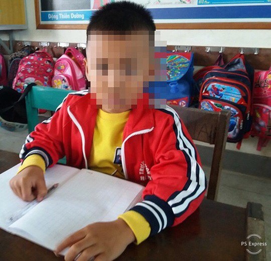 Chép nhầm đề, học sinh lớp 1 bị cô chủ nhiệm tát nhập viện - Ảnh 1. Chép nhầm đề, học sinh lớp 1 bị cô chủ nhiệm tát nhập viện - Ảnh 1.