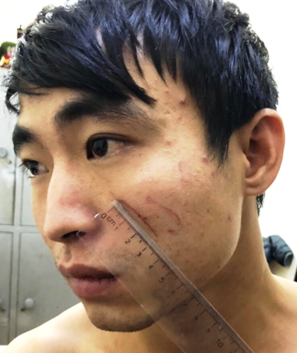 Sát hại người yêu trong nhà nghỉ là nữ sinh đại học do đang phê ma túy đá - Ảnh 2. Sát hại người yêu trong nhà nghỉ là nữ sinh đại học do đang phê ma túy đá - Ảnh 2.