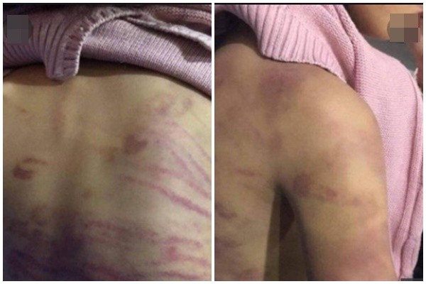 Phẫn nộ những vụ hiếp dâm trẻ em mà thủ phạm chính là yêu râu xanh mang mặt nạ người thân - Ảnh 6. Phẫn nộ những vụ hiếp dâm trẻ em mà thủ phạm chính là yêu râu xanh mang mặt nạ người thân - Ảnh 6.