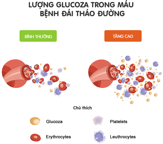 Chế độ ăn uống và bệnh đái tháo đường ảnh 1