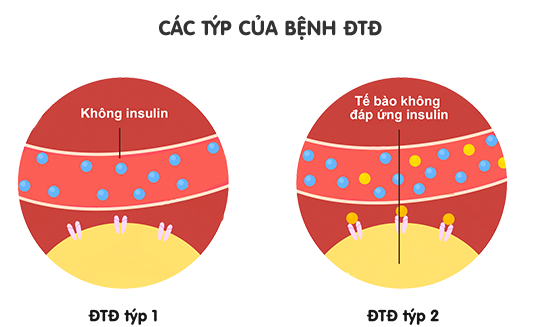 Chế độ ăn uống và bệnh đái tháo đường ảnh 2