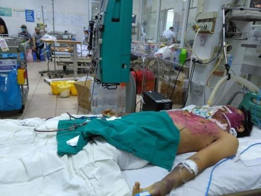 Nam bệnh nhân đang được các bác sĩ áp dụng nhiều thủ thuật hồi sức nhưng tiên lượng rất xấu. Ảnh: V.Thu