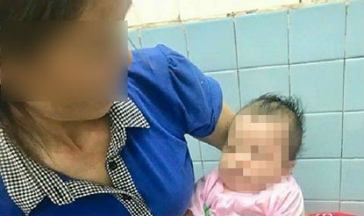 Một đứa bé ở Nghệ An bị chó cắn khi đang nằm ngủ trên võng