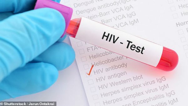 Ảnh minh họa về virus HIV.