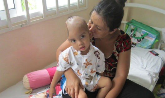 Trong đợt xạ trị, đôi mắt bé Đạt lúc nào cũng ứa nước vì đau đớn.