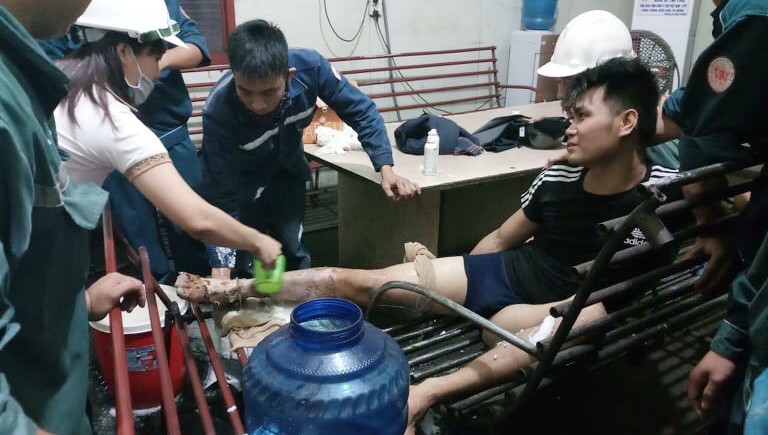 Tụt chân xuống rãnh lò đang luyện gang, nam công nhân bỏng nặng