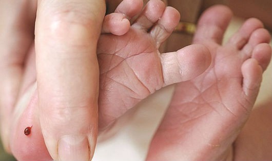 Suy giáp bẩm sinh: Con khỏe nhờ cha mẹ!