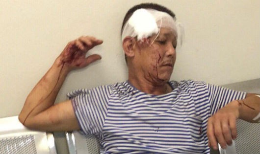 Ông Nguyễn Chí Huấn được sơ cứu tại trụ sở công an phường