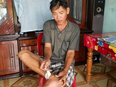 Ông Lê Minh Quang bị thương tích khâu 4 mũi.