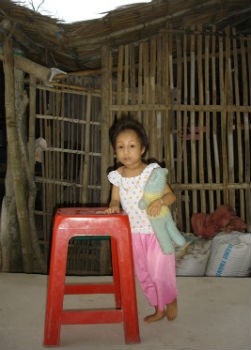 Cháu bé tí hon này 11 năm qua đã sống cuộc đời cơ cực