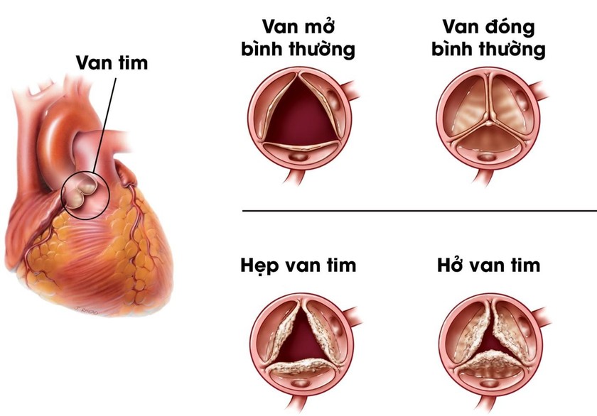 Các Phương Pháp Chẩn Đoán